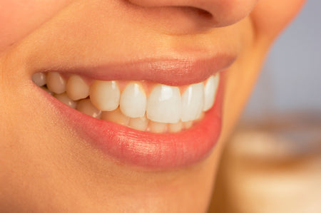 Teeth straightening alternatives if you don’t want a brace